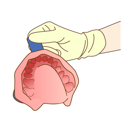 歯のクリーニング・型取り